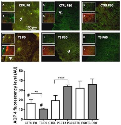 Evidence of Aquaporin 4 Regulation by Thyroid Hormone During Mouse Brain Development and in Cultured Human Glioblastoma Multiforme Cells